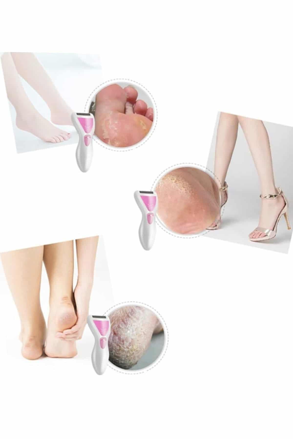 Epilatör Cihazı Epilasyon Aleti Çoklu Başlık Seçeneği Ayak Törpüsü - Görsel 2