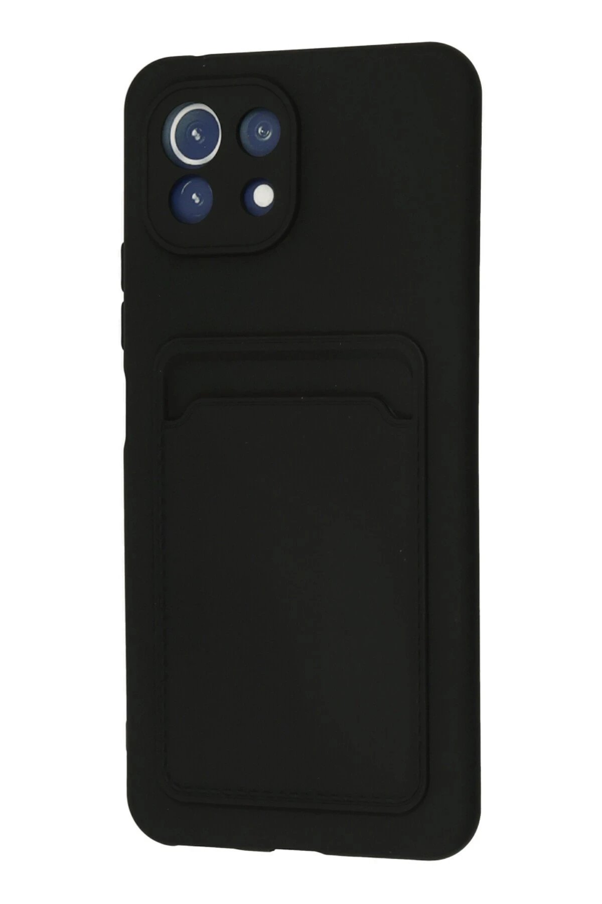 Xiaomi Mi 11 Kılıf Kelvin Kartvizitli Silikon - Siyah-(5796) - Görsel 3