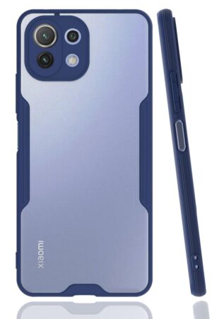 Xiaomi Mİ 11 Lite Kılıf Platin Silikon - Lacivert-(5796)